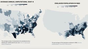 The Black American Amputation Epidemic