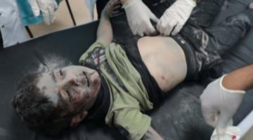 Child in a hospital in Gaza